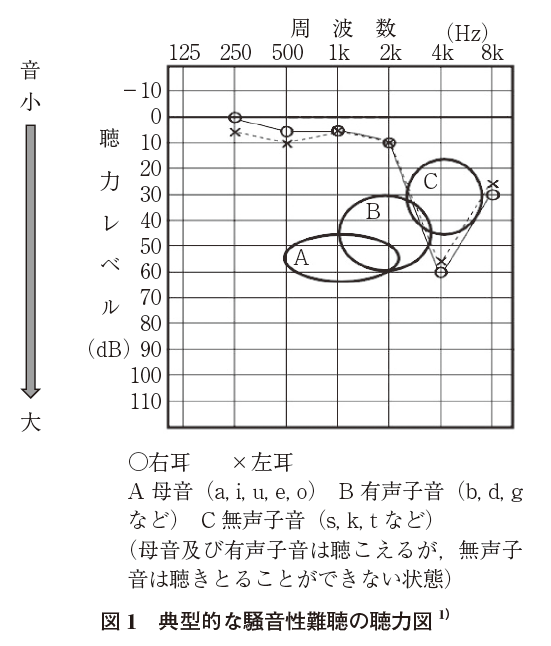 図１ 典型的な騒音性難聴の聴力図